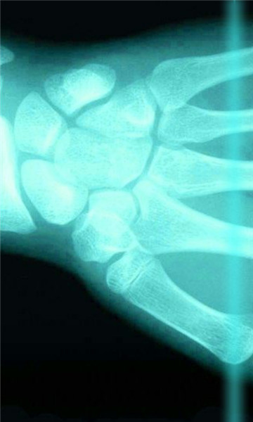 X-ray